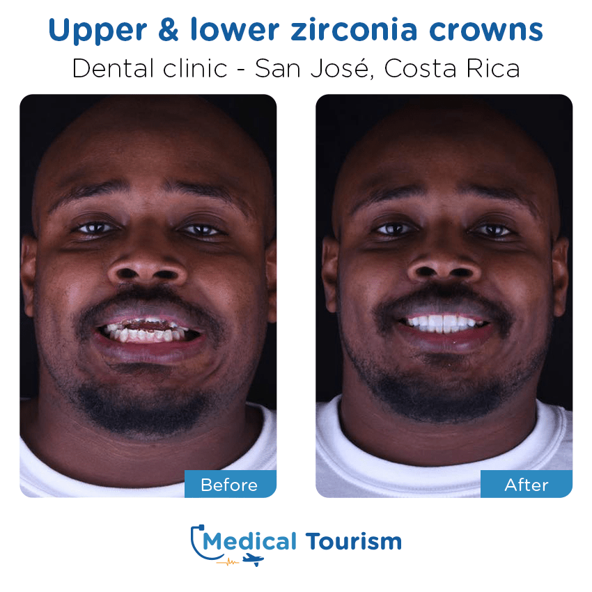 dental clinic before and after of patients in San José