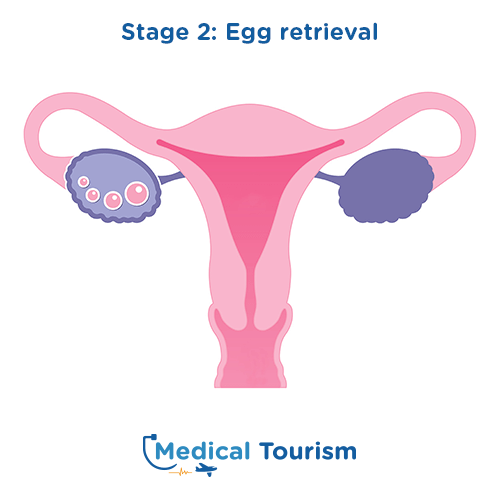 International Fertility Clinic for medical tourism