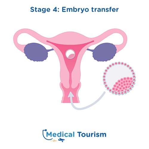 International Fertility Clinic for medical tourism